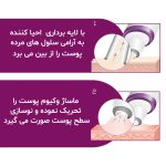 میکرودرم بیورر مدل FC 76-5